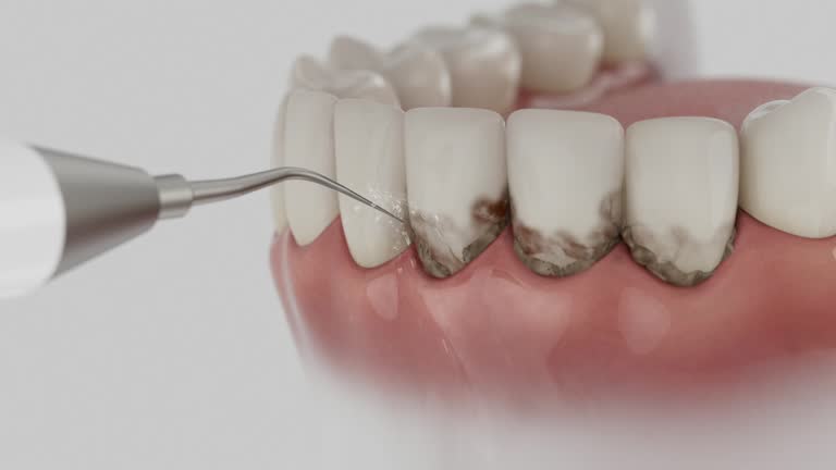 Trusted Dental Implants service in Logan, OH - Dentist Open Now
